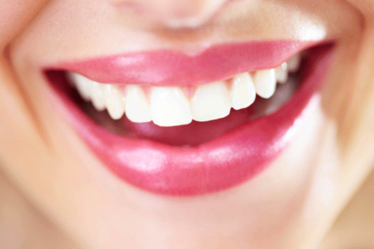 5 conseils pour avoir les dents plus blanches